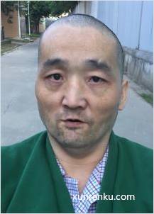 失踪人36岁(目测) 男 无名氏 精神异常 在广州市救助管理站市区分站