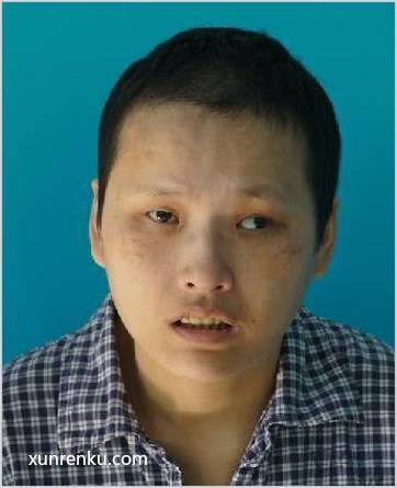 失踪人36岁(目测) 女 救助5号 智力残疾 在宁波市救助管理站