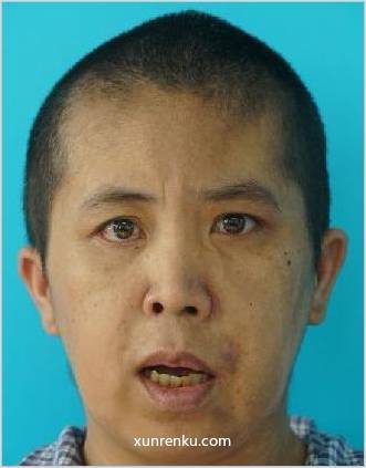 失踪人44岁(目测) 女 救助317 精神异常 在宁波市救助管理站