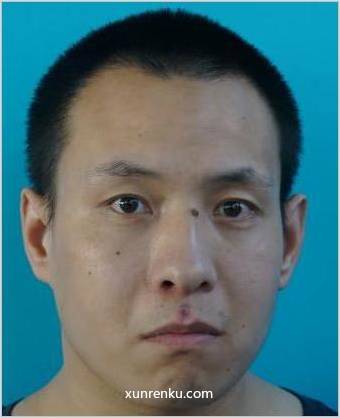 失踪人36岁(目测) 男 救助45号 精神异常 在宁波市救助管理站