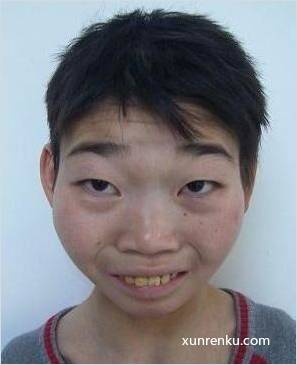 失踪人22岁(目测) 女 龙娟 智力残疾 在宁波市救助管理站