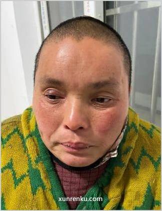 失踪人33岁(目测) 女 北杨寨3号 发色：黑 在埇桥区救助站