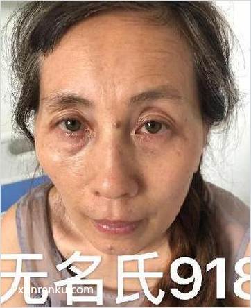 失踪人51岁(目测) 女 无名氏918 发色：灰 在武汉市救助管理站