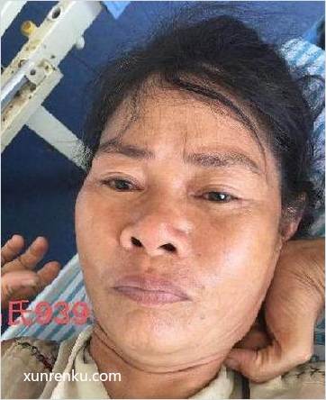 失踪人40岁(目测) 女 无名氏939 发色：黑 在武汉市救助管理站