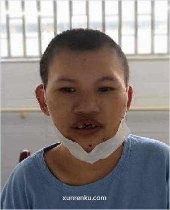 失踪人21岁(目测) 男 王双 身体残疾：先天性腭裂|||智力残疾 在广州市受助人员安置中心