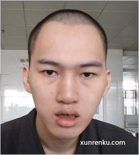 失踪人24岁(目测) 男 方庆俊 智力残疾|||精神异常 在广州市受助人员安置中心