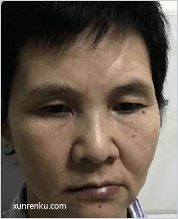 失踪人68岁(目测) 女 无名氏15012号 智力残疾|||精神异常 在德阳市救助管理站