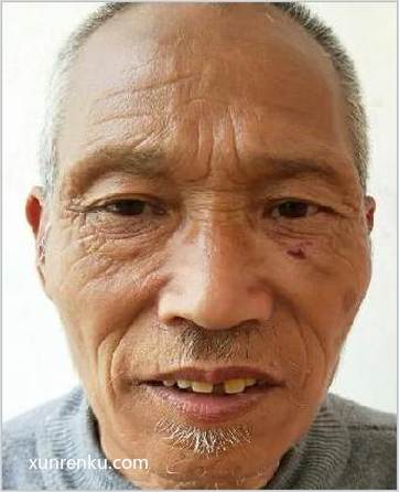 失踪人58岁(目测) 男 无名氏15030号 智力残疾|||精神异常 在德阳市救助管理站
