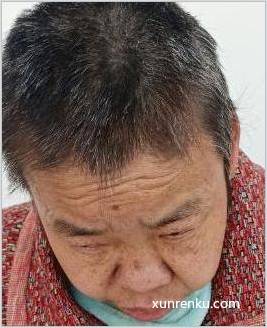 失踪人58岁(目测) 女 无名氏15042号 智力残疾|||精神异常 在德阳市救助管理站