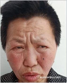 失踪人51岁(目测) 女 无名氏15045号 智力残疾|||精神异常 在德阳市救助管理站