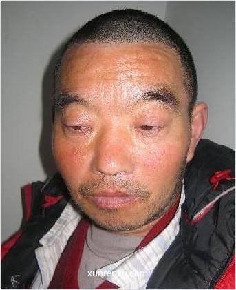失踪人40岁(目测) 男 救助484 精神异常 在绍兴市救助站