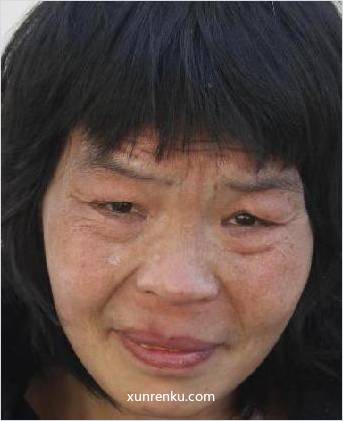 失踪人45岁(目测) 女 无名女56号 智力残疾 在十堰市级救助站