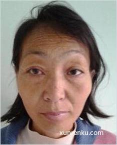 失踪人49岁(目测) 女 无名女83号 精神异常 在十堰市级救助站