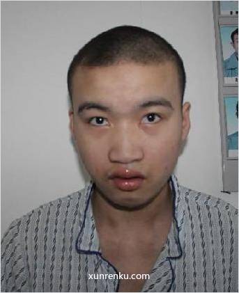 失踪人28岁(目测) 男 杜胡军 智力残疾 在温州市救助站