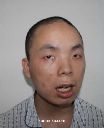 失踪人35岁(目测) 男 周宇 智力残疾 在温州市救助站