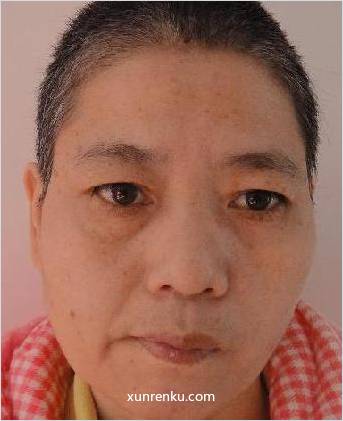 失踪人65岁(目测) 女 李花 智力残疾 在温州市救助站