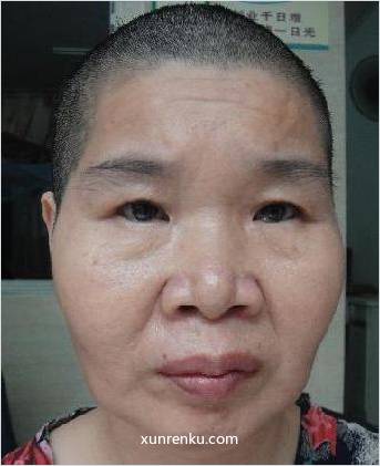 失踪人50岁(目测) 女 徐林尽 智力残疾 在温州市救助站