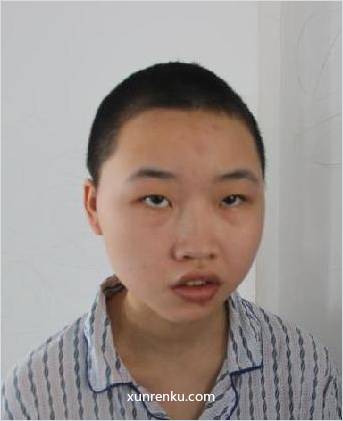 失踪人24岁(目测) 女 田水玉 智力残疾 在温州市救助站