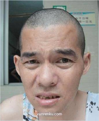 失踪人40岁(目测) 男 代红景 智力残疾 在温州市救助站