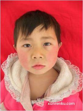 失踪人12岁(目测) 女 无名氏 发色：黑 在天津市救助管理站
