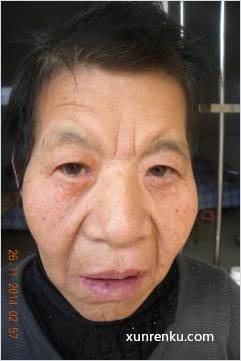 失踪人60岁(目测) 女 无名氏 发色：黑 在天津市救助管理站