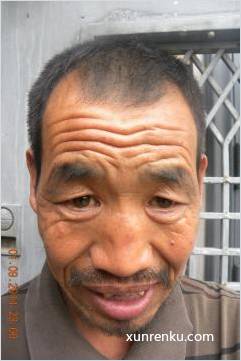 失踪人45岁(目测) 男 党红德 发色：黑 在天津市救助管理站