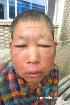 失踪人52岁(目测) 男 不详 发色：黑 在天津市救助管理站