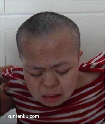 失踪人34岁(目测) 女 救月 智力残疾|||精神异常 在滁州市救助站