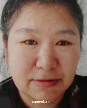 失踪人43岁(目测) 女 尹娜 精神异常 在伊春市救助站