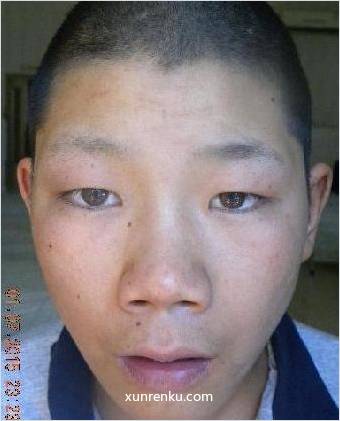 失踪人26岁(目测) 男 无名氏 发色：黑 在天津市救助管理站