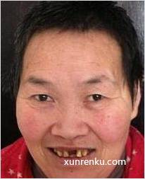 失踪人65岁(目测) 女 00011 智力残疾 在江阴市救助站