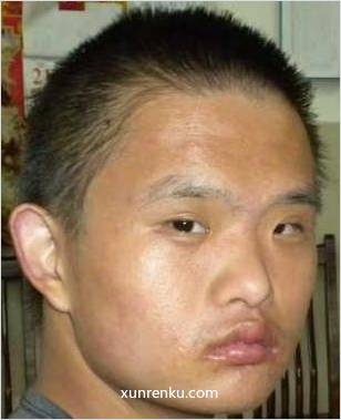 失踪人25岁(目测) 男 00077 发色：黑 在江阴市救助站