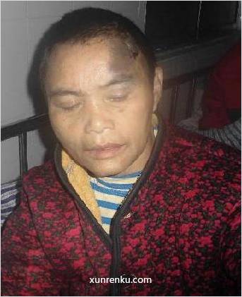 失踪人62岁(目测) 女 无名女35 精神异常 在柘城县救助站