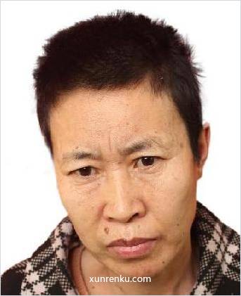 失踪人44岁(目测) 女 姜东北（暂用名） 有胎记：嘴角右上方一黑志|||智力残疾|||精神异常 在忻州市救助管理站