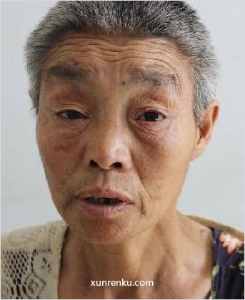 失踪人56岁(目测) 女 柳格无名女3 发色：灰 在清丰县救助站