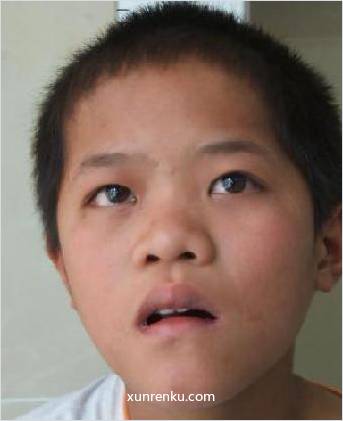 失踪人19岁(目测) 男 韩友 智力残疾 在汕头市救助站