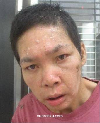 失踪人58岁(目测) 女 林细妹 智力残疾 在汕头市救助站