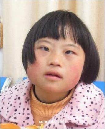 失踪人13岁(目测) 女 婷婷 智力残疾 在汕头市救助站