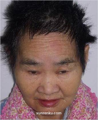 失踪人62岁(目测) 女 丁玲 智力残疾|||精神异常：精神残疾 在济宁市救助站