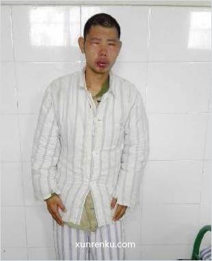 失踪人37岁(目测) 男 流浪3 智力残疾|||精神异常 在辉县市救助管理站