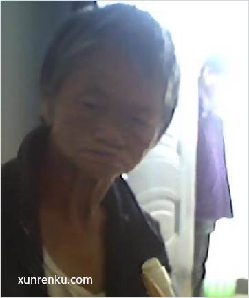 失踪人60岁(目测) 女 无名氏 身体残疾：嘴巴歪斜。|||智力残疾：痴呆。|||精神异常：精神障碍。 在宿松县救助站