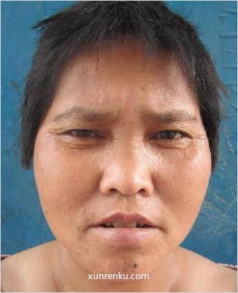 失踪人37岁(目测) 女 150530 精神异常 在永城市救助站