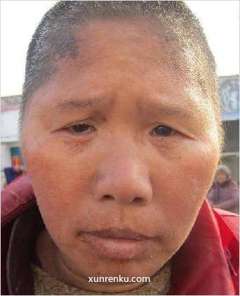 失踪人46岁(目测) 女 150227 发色：黑 在永城市救助站