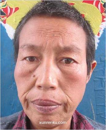 失踪人54岁(目测) 女 140109 发色：黑 在永城市救助站
