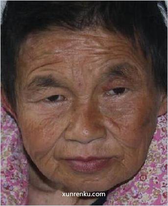 失踪人54岁(目测) 女 党恩冬 智力残疾|||精神异常：精神异常 在济宁市第一救助管理站
