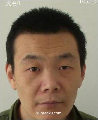 失踪人36岁(目测) 男 许祖宁（无名4） 精神异常：精神异常 在济宁市第一救助管理站