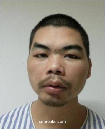 失踪人35岁(目测) 男 陈宏永 智力残疾|||精神异常 在唐山市救助站