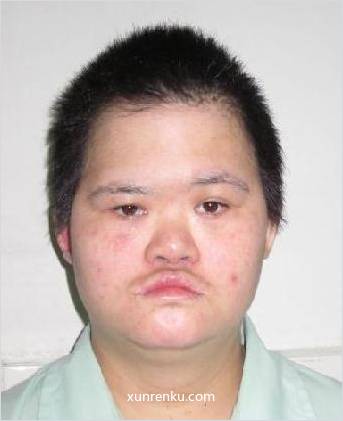 失踪人41岁(目测) 女 龙女 智力残疾|||精神异常 在广州市番禺区救助站