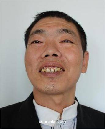 失踪人50岁(目测) 男 无名氏 智力残疾：智力障碍，反应迟钝 在张家港市救助站