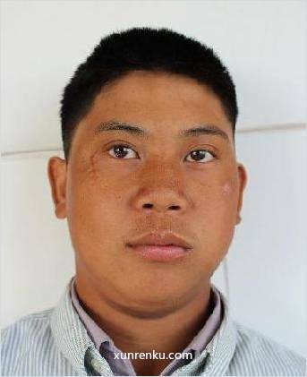 失踪人25岁(目测) 男 无名氏 智力残疾：智力障碍，反应迟钝 在张家港市救助站